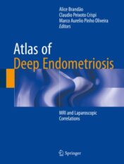 Atlas of Deep Endometriosis MRI and Laparoscopic Correlations 2018 ORIGINAL PDF
