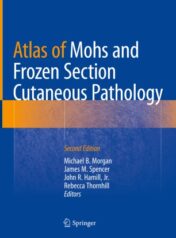 Atlas of Mohs and Frozen Section Cutaneous Pathology 2018 ORIGINAL PDF