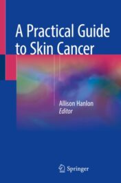 A Practical Guide to Skin Cancer 2018 ORIGINAL PDF