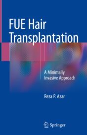 FUE Hair Transplantation A Minimally Invasive Approach 2019 ORIGINAL PDF