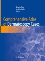 Comprehensive Atlas of Dermatoscopy Cases 2018 ORIGINAL PDF