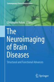The Neuroimaging of Brain Diseases Structural and Functional Advances 2018 ORIGINAL PDF