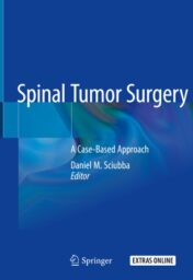 Spinal Tumor Surgery 2019 ORIGINAL PDF