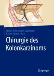 Chirurgie des Kolonkarzinoms 2021 ORIGINAL PDF