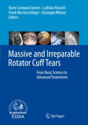 Massive and Irreparable Rotator Cuff Tears From Basic Science to Advanced Treatments 2020 Original pdf