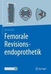 Femorale Revisionsendoprothetik 2021 Original pdf+videos