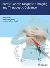 Breast Cancer: Diagnostic Imaging and Therapeutic Guidance Original pdf