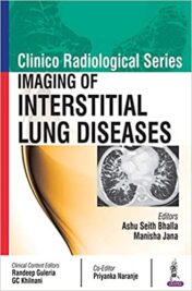 Imaging of Interstitial Lung Diseases (Clinico Radiological) (Original PDF)