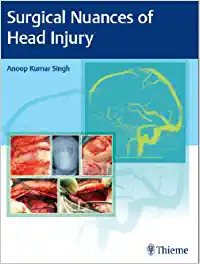 Surgical Nuances of Head Injury (Original PDF from Publisher)