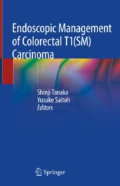 Endoscopic Management of Colorectal T1(SM) Carcinoma 2020 ORIGINAL PDF
