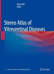 Stereo Atlas of Vitreoretinal Diseases 2020 Original pdf
