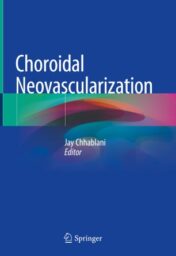 Choroidal Neovascularization 2020 Original pdf