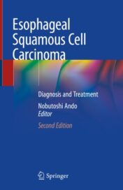 Esophageal Squamous Cell Carcinoma Diagnosis and Treatment 2020 ORIGINAL PDF