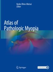 Atlas of Pathologic Myopia 2020 Original pdf+videos