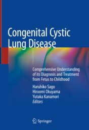 Congenital Cystic Lung Disease Comprehensive Understanding of its Diagnosis and Treatment from Fetus to Childhood 2020 ORIGINAL PDF