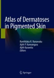 Atlas of Dermatoses in Pigmented Skin 2021 ORIGINAL PDF