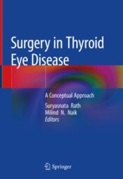 Surgery in Thyroid Eye Disease A Conceptual Approach 2020 Original pdf