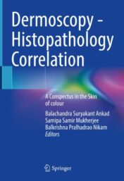 Dermoscopy - Histopathology Correlation A Conspectus in the Skin of colour 2021 ORIGINAL PDF