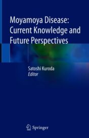 Moyamoya Disease: Current Knowledge and Future Perspectives 2021 Original pdf
