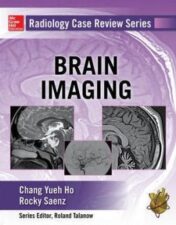 Radiology Case Review Series: Brain Imaging (ORIGINAL PDF)