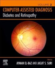 Diabetes and Retinopathy (Original PDF)