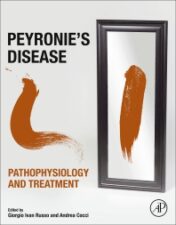 Peyronie's Disease: Pathophysiology and Treatment original pdf 2020