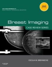 Breast Imaging: Case Review Series (PDF) 2012