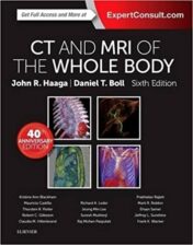 CT and MRI of the Whole Body, 2-Volume Set, 6th Edition (Original PDF)
