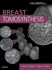 Breast Tomosynthesis (PDF)
