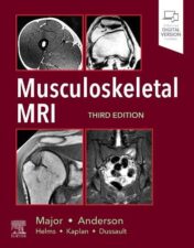 Musculoskeletal MRI, 3rd edition (Original PDF)