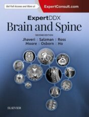 ExpertDDx: Brain and Spine, 2nd Edition (ORIGINAL PDF)
