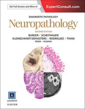 Diagnostic Pathology: Neuropathology, 2nd Edition (Original PDF with High Quality Images)