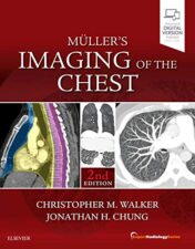 Muller’s Imaging of the Chest: Expert Radiology Series, 2ed (PDF)