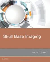 Skull Base Imaging, 1e (PDF)