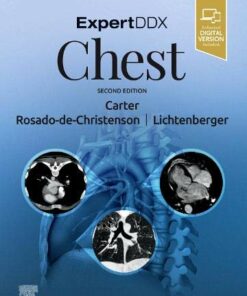 ExpertDDx: Chest, 2nd Edition (Original PDF from Publisher)