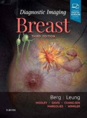 Diagnostic Imaging: Breast, 3rd Edition (Original PDF)