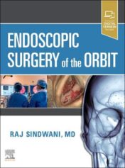 Endoscopic Surgery of the Orbit (Original PDF)