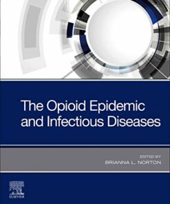The Opioid Epidemic and Infectious Diseases (Original PDF from Publisher)