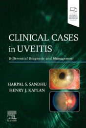 Clinical Cases in Uveitis: Differential Diagnosis and Management (True PDF+ToC+Index)