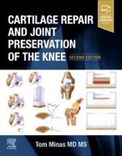 Cartilage Repair and Joint Preservation of the Knee, 2nd Edition 2021 ORIGINAL PDF