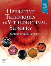 Operative Techniques in Vitreoretinal Surgery 2022 Original PDF