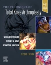 The Technique of Total Knee Arthroplasty, 2nd edition 20222 Original PDF