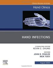 Hand Infections, An Issue of Hand Clinics (Volume 36-3) (The Clinics: Orthopedics, Volume 36-3) 2020 Original PDF