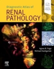 Diagnostic Atlas of Renal Pathology 2021 Original pdf