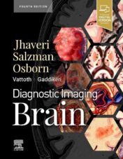 Diagnostic Imaging: Brain, 4th Edition 2020 Original PDF