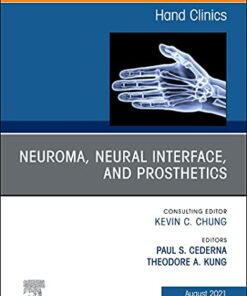 Neuroma, Neural interface, and Prosthetics, An Issue of Hand Clinics (Volume 37-3) (The Clinics: Orthopedics, Volume 37-3) (Original PDF from Publisher)