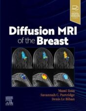 Diffusion MRI of the Breast 2022 Original PDF