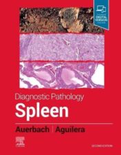 Diagnostic Pathology: Spleen, 2nd Edition 2022 Original PDF