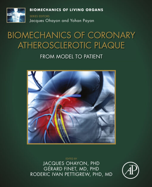 Biomechanics of Coronary Atherosclerotic Plaque: From Model to Patient (EPUB)