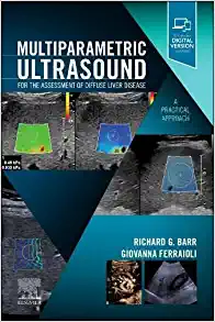 Multiparametric Ultrasound for the Assessment of Diffuse Liver Disease: A Practical Approach (Original PDF from Publisher)